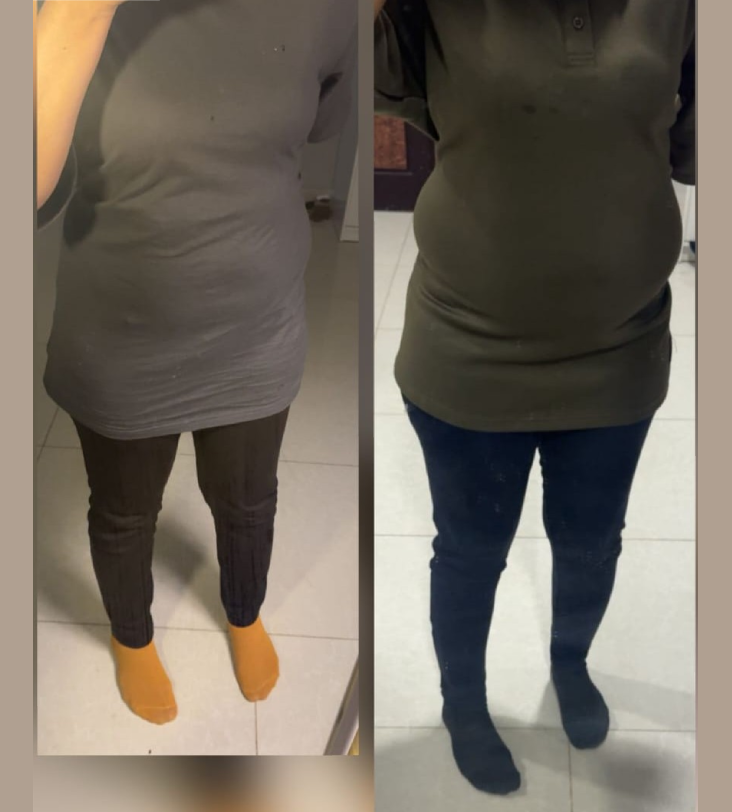 Zahraa's follow-up experience
